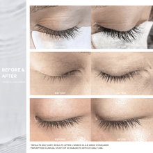Charger l'image dans la galerie, adoreyes plus lashes peptide lash serum results