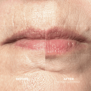 adoreyes peptide lip serum before after results review 65 years old