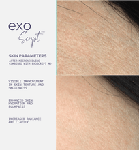 Load image into Gallery viewer, ExoScript MD™ Biomimetic Renewal Face Serum