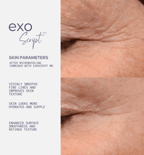 Load image into Gallery viewer, ExoScript MD™ Biomimetic Renewal Face Serum