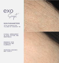 Load image into Gallery viewer, ExoScript MD™ Booster Serum Vials EXO + GF + PEP