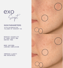 Load image into Gallery viewer, ExoScript MD™ Booster Serum Vials EXO + GF + PEP