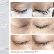 Load image into Gallery viewer, adoreyes plus lashes peptide lash serum results