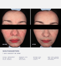 Load image into Gallery viewer, before after ExoScript MD biomimetic renewal dual exosome face serum