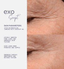 Charger l'image dans la galerie, before after exoscript md dual exosome face serum