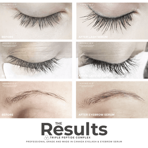 ADOREYES lash brow serum before after results