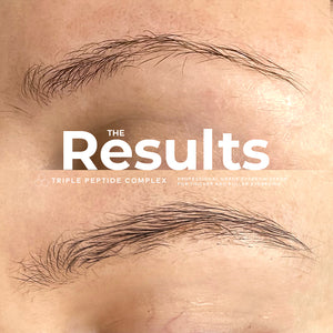 adoreyes brow serum before after results